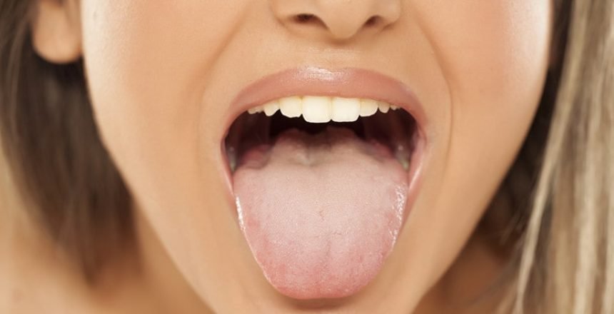 what does it mean when your tongue is white